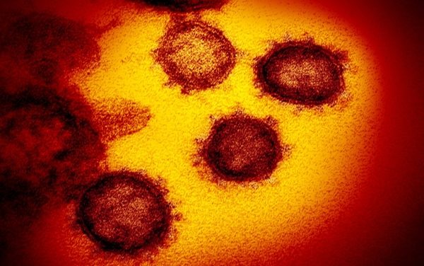 Researchers capture the first pictures showing ‘the real appearance’ of the new coronavirus