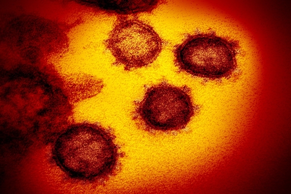 Researchers capture the first pictures showing ‘the real appearance’ of the new coronavirus